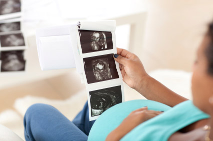 Zoloft birth defect lawsuit Zoloft birth defect lawsuit