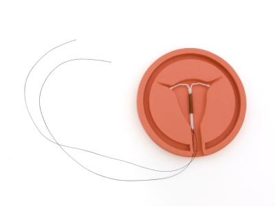 IUD injury lawsuit IUD injury lawsuit